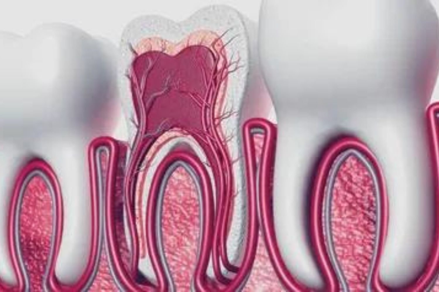 Laser Root Canal Treatments